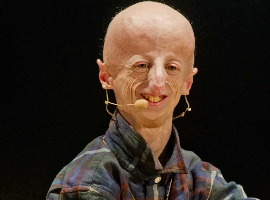 Sammy Basso va in scena, ed emoziona tutti